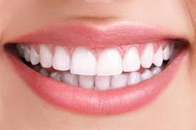 Dental Implants Image 1